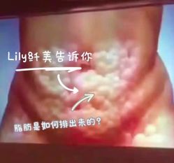 -Lily纤美·科技减脂中心