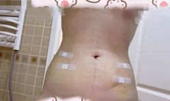 -洁铭新加坡医美