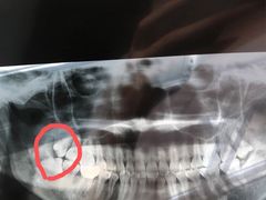 -宁波口腔医院(鄞州分院)