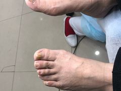 -派恩宜灰指甲(勤业店)