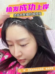 -雍禾植发全国连锁