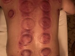 -智慧盲人按摩艾灸-颈肩腰膝疼痛调理(浦东店)