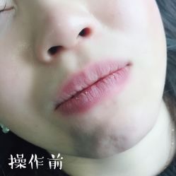 -西施无菌半永久纹绣眉眼影唇轻增发纹发际线