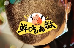 -大麦微针植发全国连锁