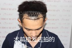 -熙朵美学植发·连锁品牌