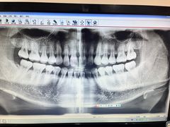 -赫尔森口腔·牙齿种植修复