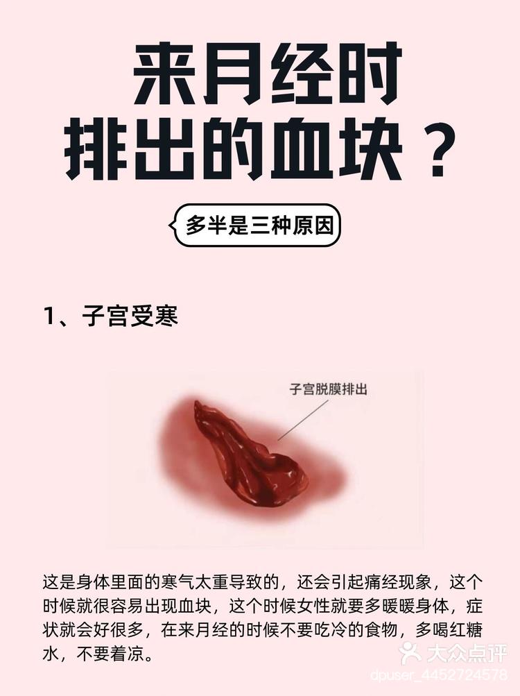 月经血块图片 内膜图片