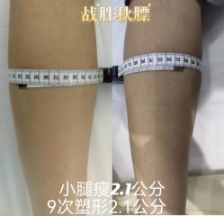 -Lily纤美·科技减脂中心