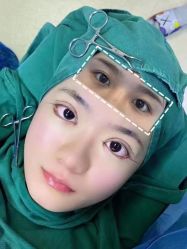 -郡艺医疗美容·微整·眼鼻吸脂