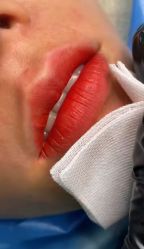 -尚玲纹绣纹眉特价店