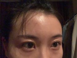 体验后-Dr.U博士医疗美容医院