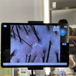 -润复丝·泽发防脱头皮管理