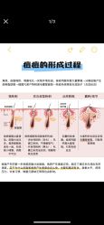 -克丽缇娜