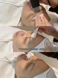 点击看大图 -美肤盾祛痘·问题肌头疗管理中心