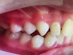 -宁波壹加壹口腔·矫正种植中心