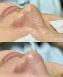 -蕾特恩专业祛痘·皮肤管理