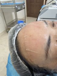 -长沙雅美医疗美容医院