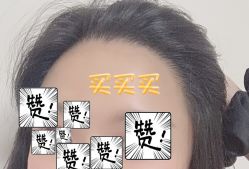 -大麦微针植发全国连锁