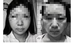 体验后-上海首尔丽格医疗美容医院