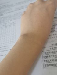体验后-石家庄苏亚美联臣医疗美容医院