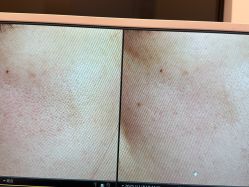 -苑苑vbeauty科技美容SPA