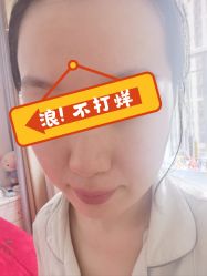 体验后-青岛诺德医学美容医院
