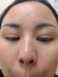 -长沙雅美医疗美容医院
