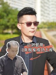 -唐风采假发补发定制
