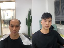 -发饰美男士增发补发假发定制店