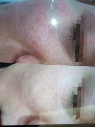 点击看大图 -SKIN79皮肤管理中心