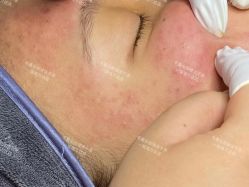 -Cream88颜皮肤管理中心