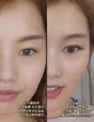 点击看大图 -瑾秀美肤·问题肌修护