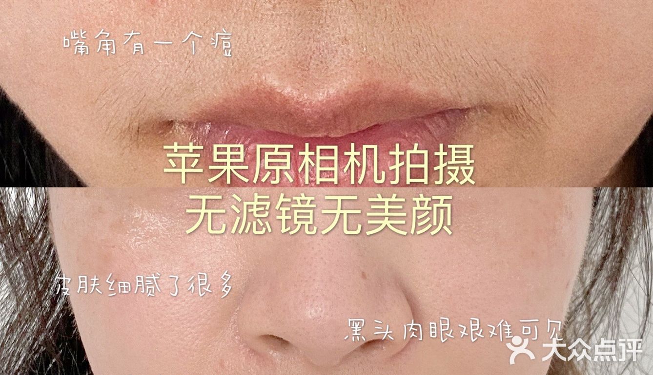 我的万年黑头洗没了，再也不用去做小气泡了