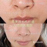 我的万年黑头洗没了，再也不用去做小气泡了