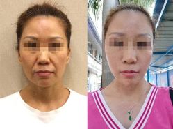 -加减美医美连锁品牌