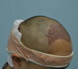 体验后-厦门美莱整形美容医院