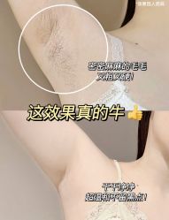 -植蔻妍倍儿专业脱毛·皮肤管理