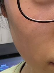 -宁波美莱整形美容
