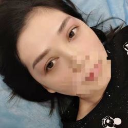 点击看大图 -郡艺医疗美容·微整·眼鼻吸脂