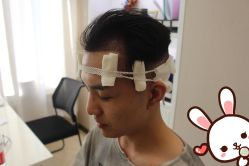 -大麦微针植发丨全国连锁