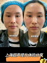 -上海漾颜医疗美容