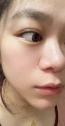 体验后-唯奈斯肌肤管理中心