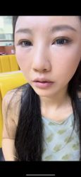 体验后-南京康美美容医院·旗舰店