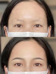 -郡艺医疗美容·微整·眼鼻吸脂