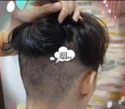 -大麦微针植发全国连锁