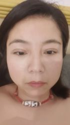 -西安壹加壹医疗美容医院