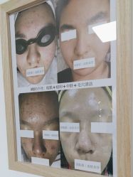 -美肤盾祛痘·问题肌头疗管理中心