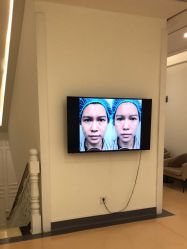 点击看大图 -广州健丽·去眼袋医疗美容机构