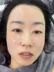 -北京豆豆博士专业祛痘
