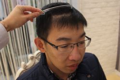 点击看大图 -大麦微针植发丨全国连锁